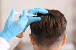 prp procedūra plaukams