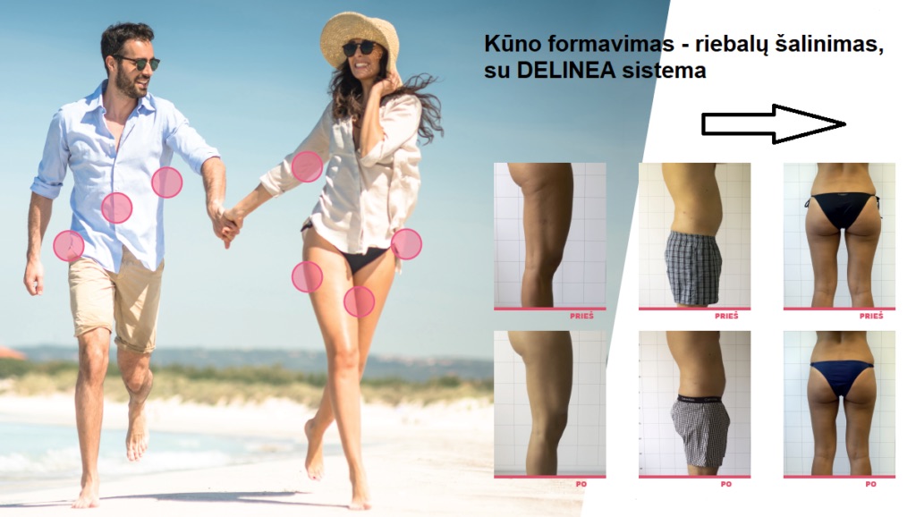 dermatovenerologo paslaugos