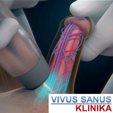 erekcijos sutrikimų gydymas