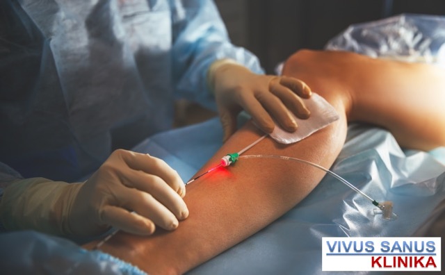 venu varikozes gydymas lazeriu medium